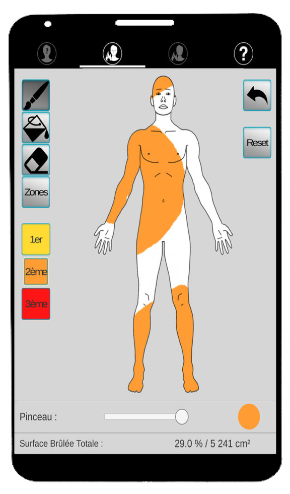 Image is not available